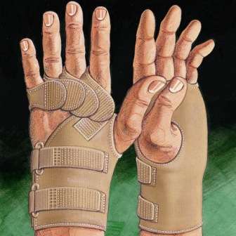 Hand & Arm Splints